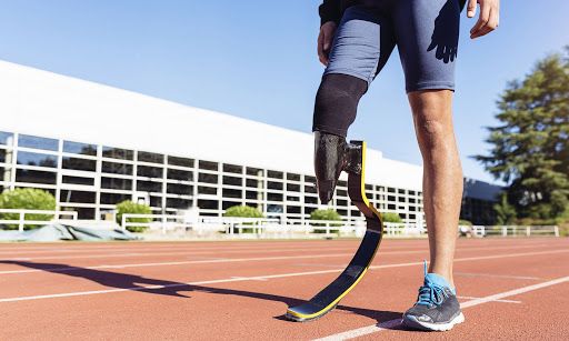 Современные протезы позволяют в достаточной степени вести полноценную жизнь