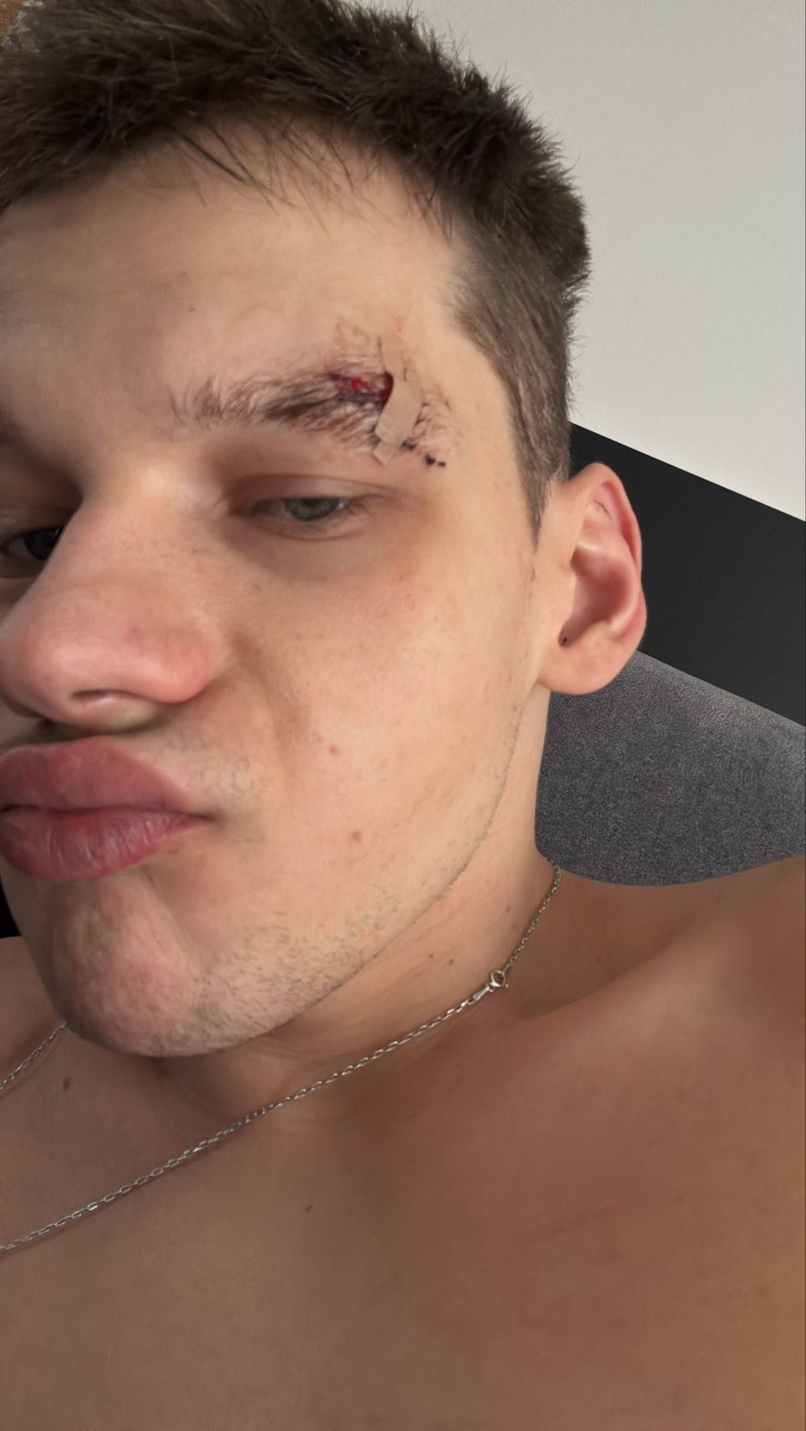 Травма frozen. Источник: frozen в X