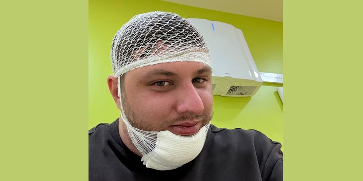 SQreen упал с байка — ему понадобилась медицинская помощь